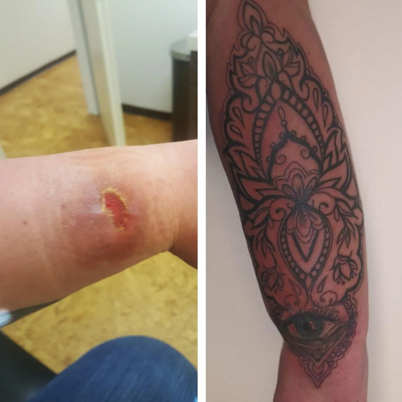Ingesś Tattoo & Piercing Stübchen Wunde am Arm and tattoo
