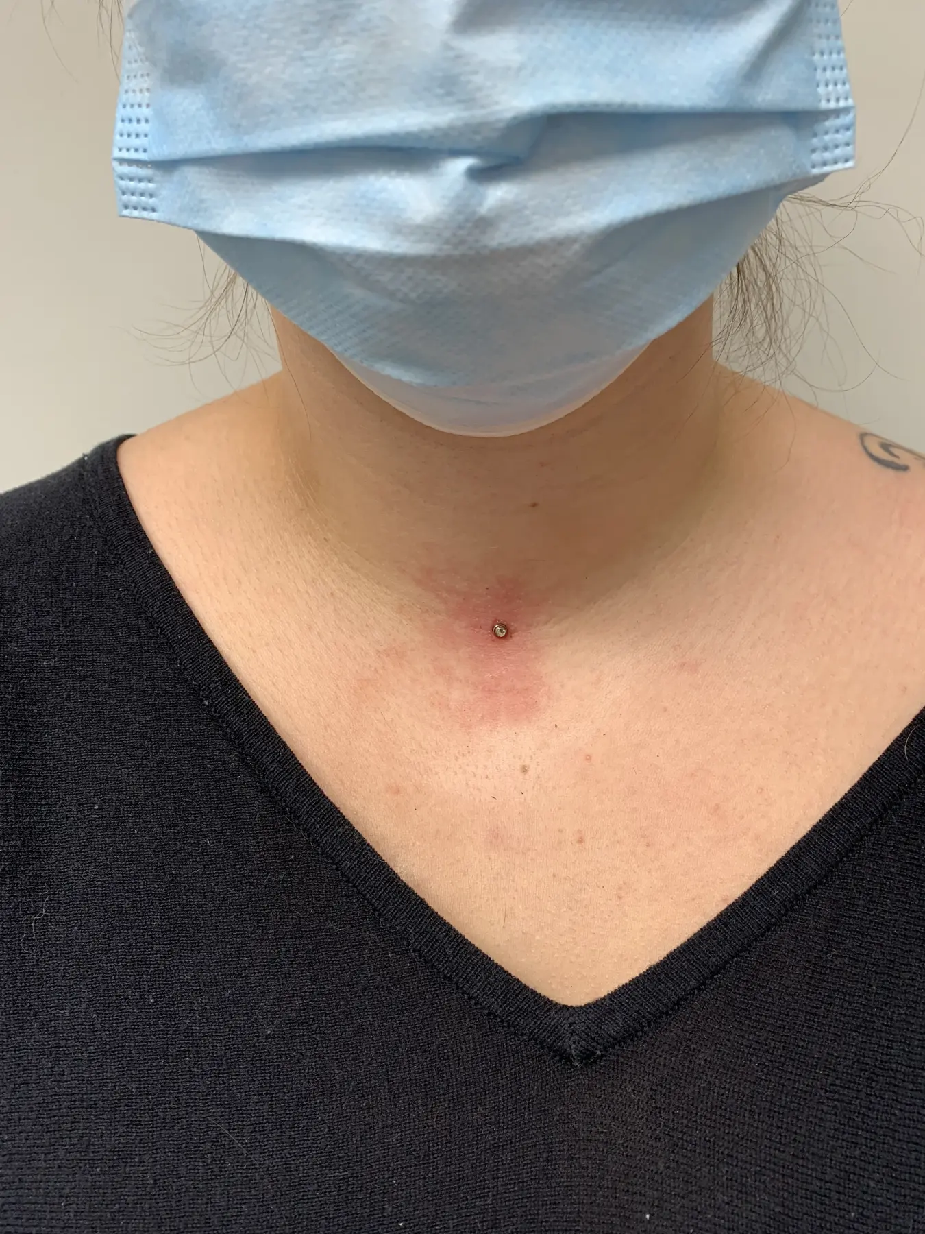 Ingesś Tattoo&Piercing Stübchen Durchbohrter Hals